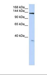 293T cell lysate. Antibody concentration: 1.0 ug/ml. Gel concentration: 6-18%.