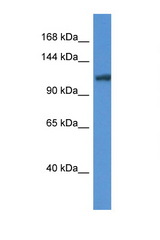 ANO6 antibody LS-C135165 Western blot of Mouse Liver lysate. Antibody concentration 1 ug/ml.
