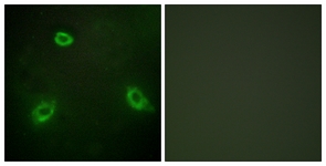 Immunofluorescence of HepG2 cells, using TM16G Antibody. The picture on the right is treated with the synthesized peptide.