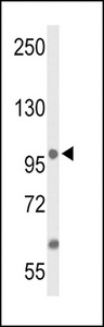 Western blot of ANO7 Antibody in MCF-7 cell line lysates (35 ug/lane). ANO7 (arrow) was detected using the purified antibody.