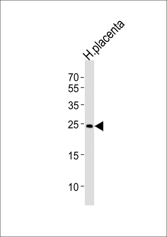 Western blot of lysate from human placenta tissue lysate, using ANP32B Antibody. Antibody was diluted at 1:1000 at each lane. A goat anti-rabbit IgG H&L (HRP) at 1:5000 dilution was used as the secondary antibody. Lysate at 35ug per lane.