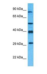 Western blot of AN32B Antibody with human MCF7 Whole Cell lysate.