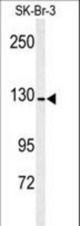 Western blot of ANPEP antibody in SK-Br-3 cell line lysates (35 ug/lane). ANPEP (arrow) was detected using the purified antibody.