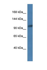 ANPEP / CD13 antibody LS-C135915 Western blot of Jurkat Cell lysate. Antibody concentration 1 ug/ml.
