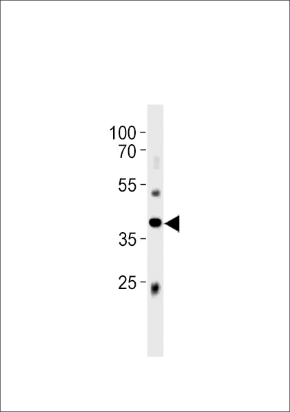 Mouse Abi3 Antibody western blot of mouse liver tissue lysates (35 ug/lane). The Abi3 antibody detected the Abi3 protein (arrow).