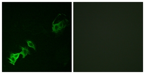 Immunofluorescence of A549 cells, using Abl (Phospho-Tyr393/412) Antibody. The picture on the right is treated with the synthesized peptide.