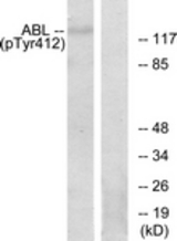 Western blot of extracts from RAW264.7 cells, using Abl (Phospho-Tyr393/412) Antibody. The lane on the right is treated with the synthesized peptide.