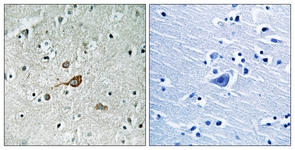 IHC of paraffin-embedded human brain tissue, using c-Abl (Ab-412) Antibody. The picture on the right is treated with the synthesized peptide.