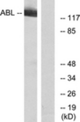 Western blot of extracts from RAW264.7 cells, using c-Abl (Ab-412) Antibody. The lane on the right is treated with the synthesized peptide.
