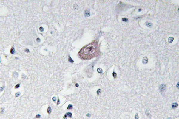 IHC of p-Abl1/2 (Y393/439) pAb in paraffin-embedded human brain tissue.