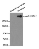 Western blot analysis of extracts from HL60 cells using phospho-ABL1/2-Y393/429 antibody and the same antibody preincubated with blocking peptide.