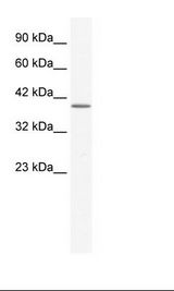 Jurkat Cell Lysate