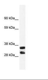 Fetal Small intestine Lysate