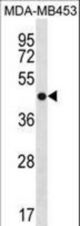 ANXA13 Antibody western blot of MDA-MB453 cell line lysates (35 ug/lane). The ANXA13 antibody detected the ANXA13 protein (arrow).