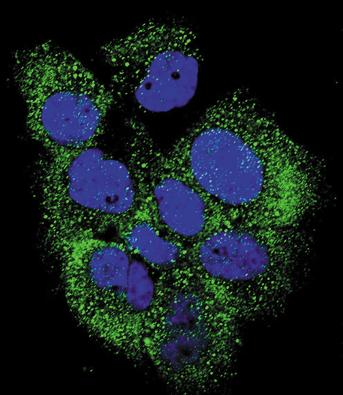 Confocal immunofluorescent of Phospho-ABL-Y185 Antibody with MCF-7 cell followed by Alexa Fluor 488-conjugated goat anti-rabbit lgG (green). DAPI was used to stain the cell nuclear (blue).