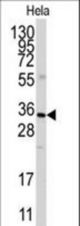 Western blot of anti-ANXA3 Antibody in HeLa cell line lysates (35 ug/lane). ANXA3(arrow) was detected using the purified antibody.