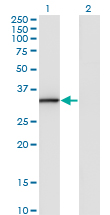 Western blot of ANXA3 expression in transfected 293T cell line by ANXA3 monoclonal antibody (M07), clone 1E2.
