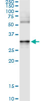 Immunoprecipitation of ANXA3 transfected lysate using anti-ANXA3 monoclonal antibody and Protein A Magnetic Bead.