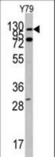 Western blot of ABL1 Antibody (N-term H246) in Y79 cell line lysates (35 ug/lane). ABL1(arrow) was detected using the purified antibody.