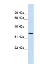 ANXA4 / Annexin IV antibody western blot of Fetal Lung lysate.