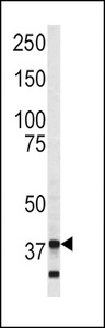 Western blot of Annexin V antibody in SK-Br-3 cell line lysates (35 ug/lane). Annexin V (arrow) was detected using the purified antibody.