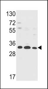 Western blot of Annexin V Antibody in HepG2,A2058,T47D cell line lysates (35 ug/lane). ANXA5 (arrow) was detected using the purified antibody.