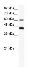 Jurkat Cell Lysate