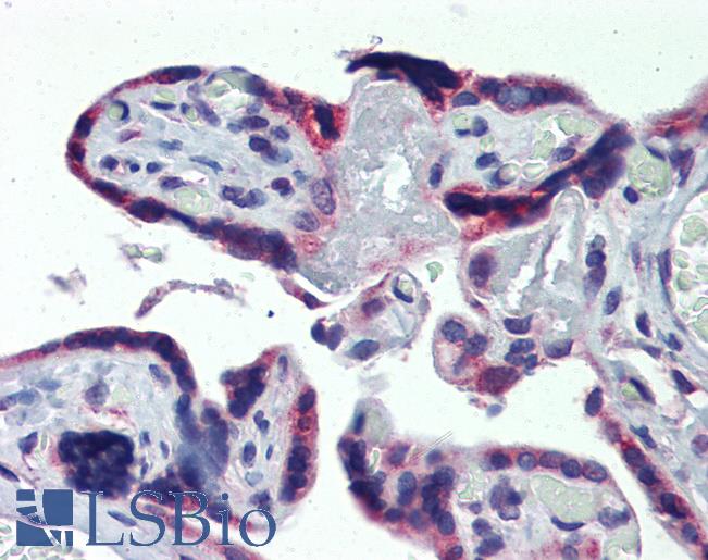 Anti-AAK1 antibody IHC of human placenta. Immunohistochemistry of formalin-fixed, paraffin-embedded tissue after heat-induced antigen retrieval. Antibody LS-B3833 concentration 5 ug/ml.