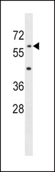 AOAH Antibody western blot of mouse liver tissue lysates (35 ug/lane). The AOAH antibody detected the AOAH protein (arrow).