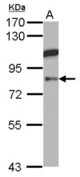 Sample (30 ug of whole cell lysate) A: HCT116 7.5% SDS PAGE ABP1 antibody diluted at 1:1000