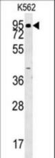 ABP1 Antibody western blot of K562 cell line lysates (35 ug/lane). The ABP1 antibody detected the ABP1 protein (arrow).