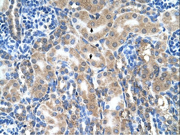 ABP1 antibody LS-C80469 was used in IHC to stain formalin-fixed, paraffin-embedded human kidney.