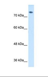 HepG2 cell lysate. Antibody concentration: 1.0 ug/ml. Gel concentration: 8%.