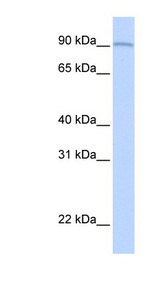 AOC2 antibody LS-C102156 Western blot of Fetal Lung lysate.
