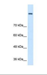 Jurkat cell lysate. Antibody concentration: 1.0 ug/ml. Gel concentration: 8%.