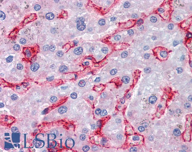 Anti-AOC3 / VAP-1 antibody IHC of human liver. Immunohistochemistry of formalin-fixed, paraffin-embedded tissue after heat-induced antigen retrieval. Antibody LS-B2763 concentration 75 ug/ml.