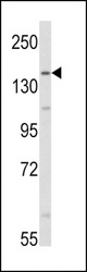 Western blot of AOX1 Antibody in HepG2 cell line lysates (35 ug/lane). AOX1 (arrow) was detected using the purified antibody.