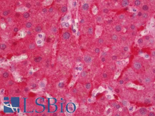 Human Liver: Formalin-Fixed, Paraffin-Embedded (FFPE)