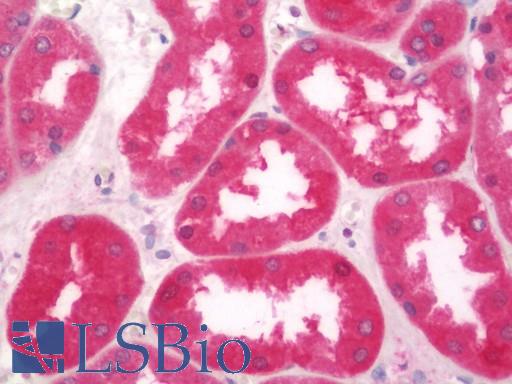 Human Kidney: Formalin-Fixed, Paraffin-Embedded (FFPE)
