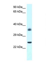 JUND antibody LS-C145528 Western blot of Rat Brain lysate. Antibody concentration 1 ug/ml.