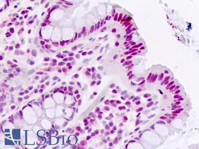 Human Colon: Formalin-Fixed, Paraffin-Embedded (FFPE)