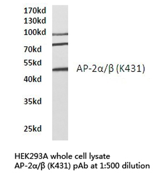 Western blot of AP-2/ (K431) pAb in extracts from HEK293A cells.