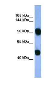 AP1B1 antibody LS-C135683 Western blot of Fetal Muscle lysate.