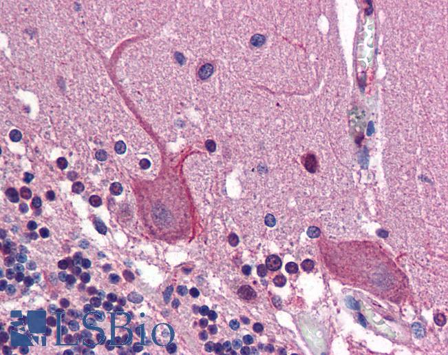Anti-AP1G1 / Gamma Adaptin antibody IHC of human brain, cerebellum. Immunohistochemistry of formalin-fixed, paraffin-embedded tissue after heat-induced antigen retrieval. Antibody LS-B5827 concentration 2.5 ug/ml.