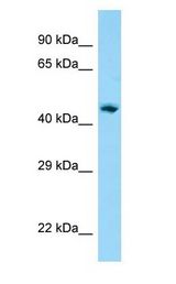 AP1M1 antibody Western Blot of Human Lung.