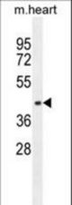 AP1M1 Antibody western blot of mouse heart tissue lysates (35 ug/lane). The AP1M1 antibody detected the AP1M1 protein (arrow).