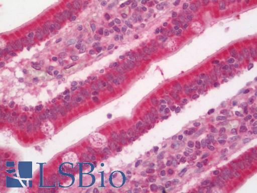 Human Small Intestine: Formalin-Fixed, Paraffin-Embedded (FFPE)