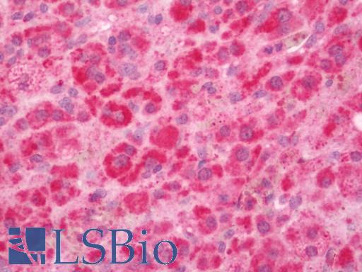 Human Adrenal: Formalin-Fixed, Paraffin-Embedded (FFPE)