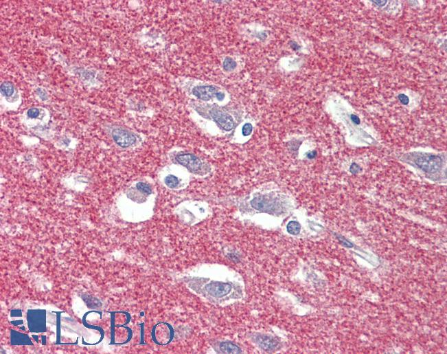 Anti-AP2A1 / AP2-Alpha antibody IHC staining of human brain, cortex. Immunohistochemistry of formalin-fixed, paraffin-embedded tissue after heat-induced antigen retrieval. Antibody LS-B9566 concentration 5 ug/ml.