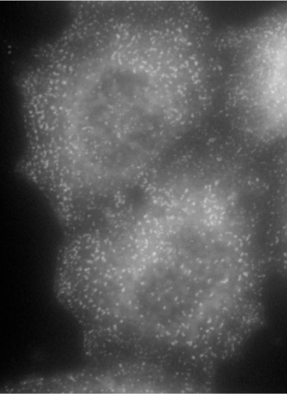 AP2A1 antibody (0.1 ug/ml) staining of methanol-fixed HeLa cells with stably expressing Mouse Ap2a1. Primary incubation was 1 hour. Detected by Alexa Fluor 594. Data obtained from Prof. M Robinson, CIMR, Cambridge, UK
